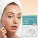 Гідроколоїдний пластир від акне та запалень на обличчі 72 шт Acne Patch 06k05p057 фото 1